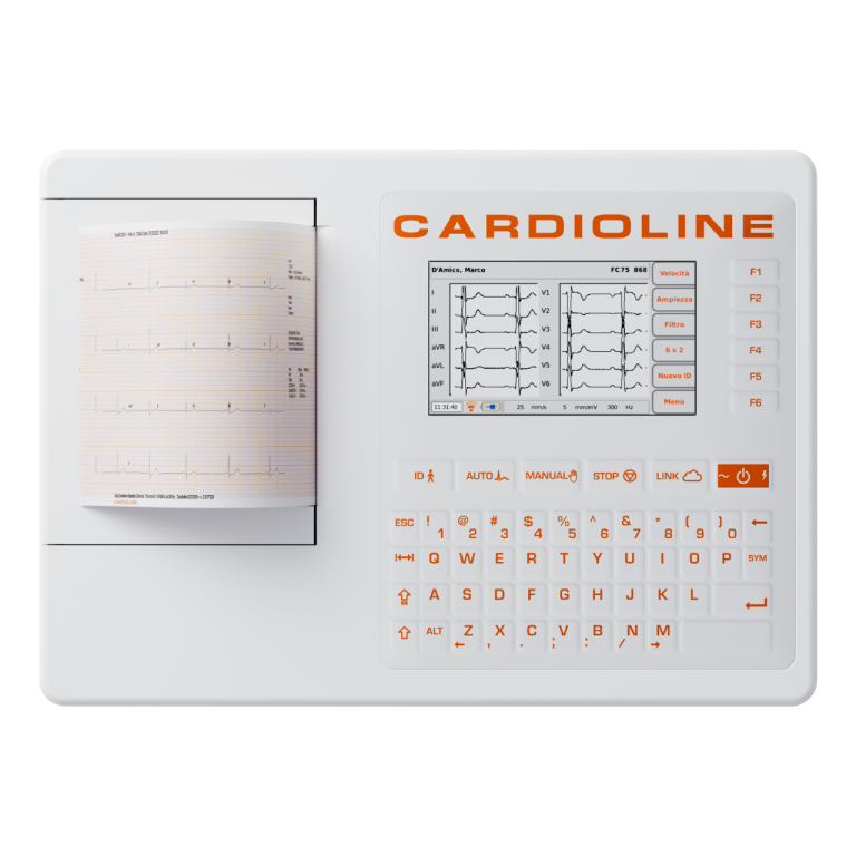 ECG100S