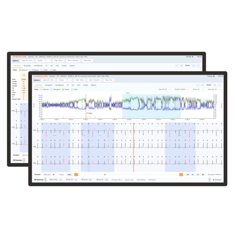 ECGWebApp-Holter_new