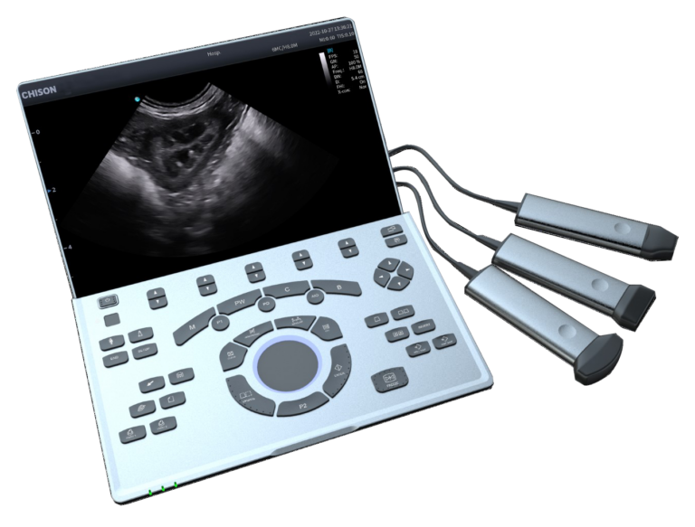 chison-sonoair-70-no-background