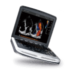 SonoBook 8